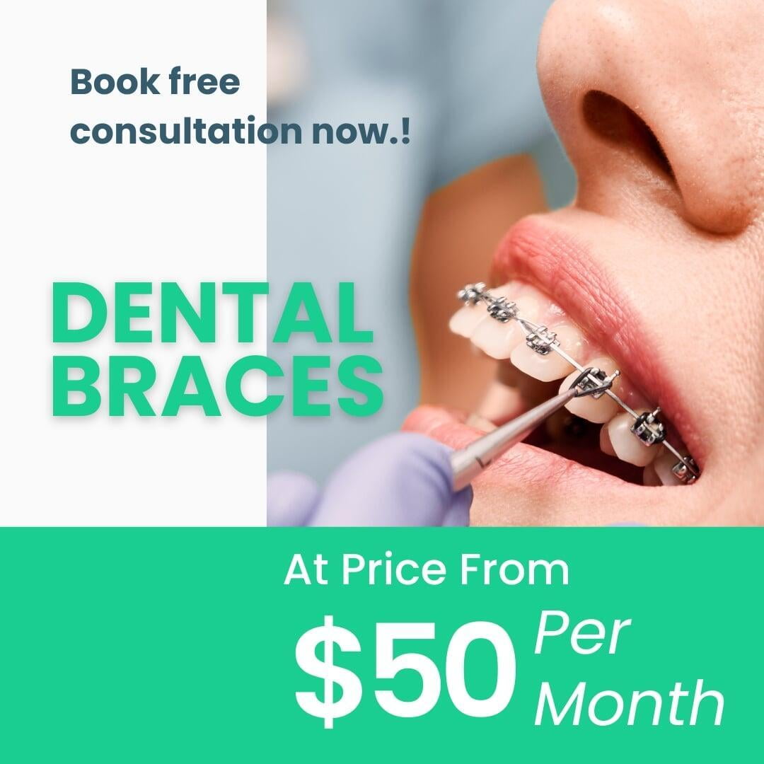 Patient getting dental braces installed in her mouth.