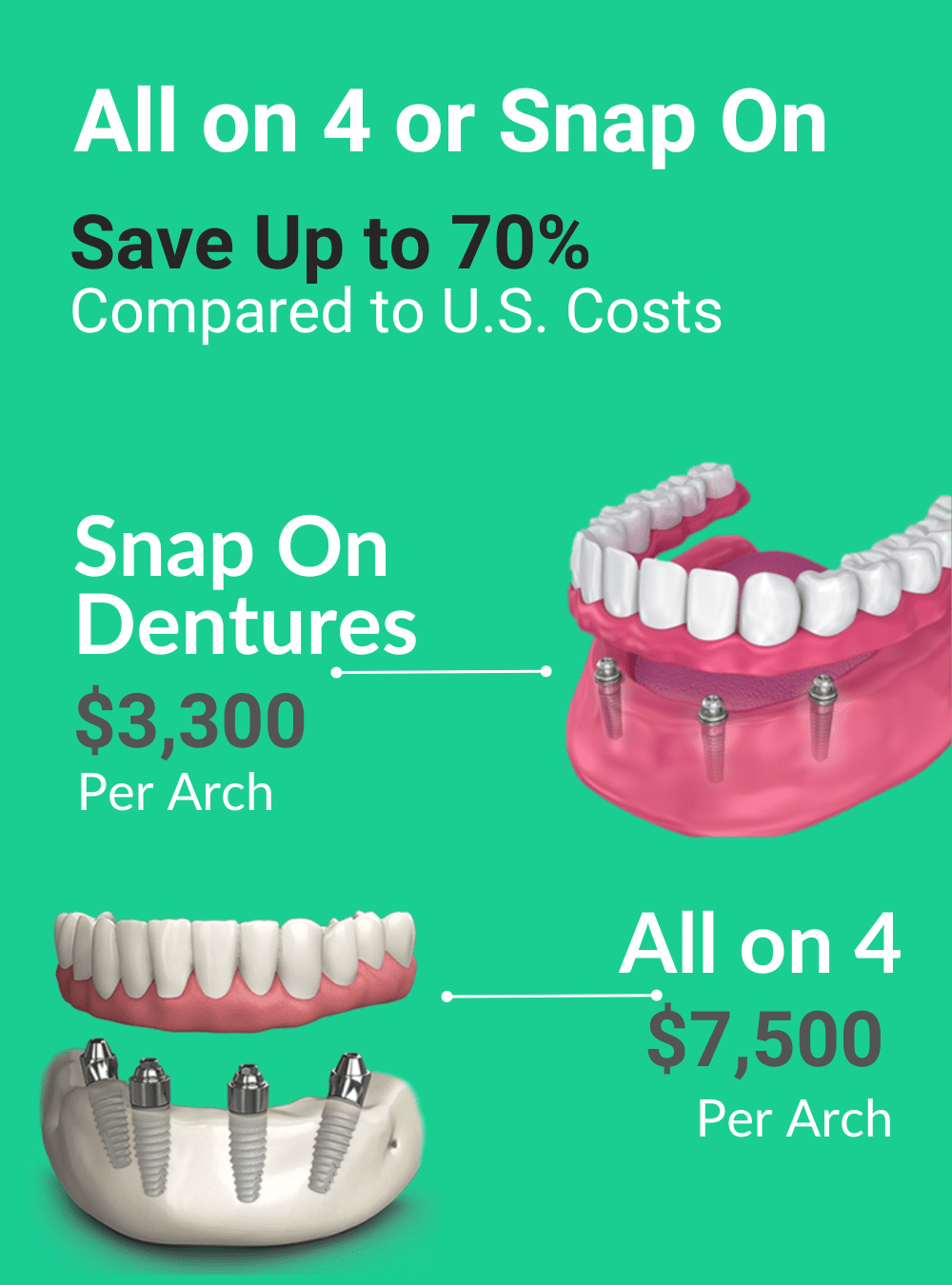 Procedures for full arch implant placement.