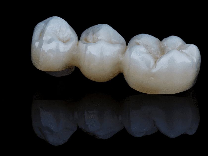 Bridge of dental crowns.