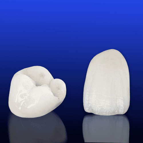 Crown of a molar and a veneer.