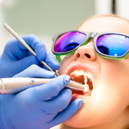 Patient with an open mouth during a dental cleaning.