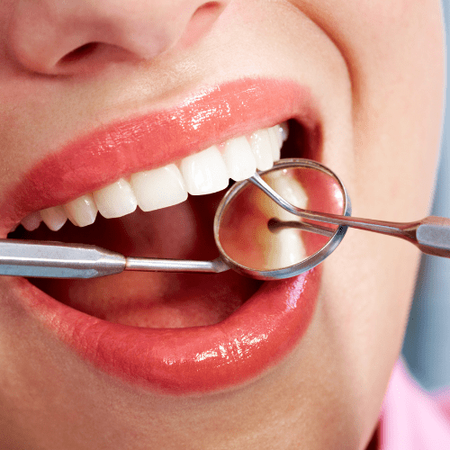Dental patient with an open mouth during an evaluation.