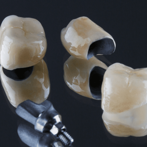 Porcelain-metal dental crowns on a mirror.