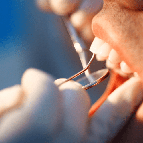 Dentist placing a post after a root canal.