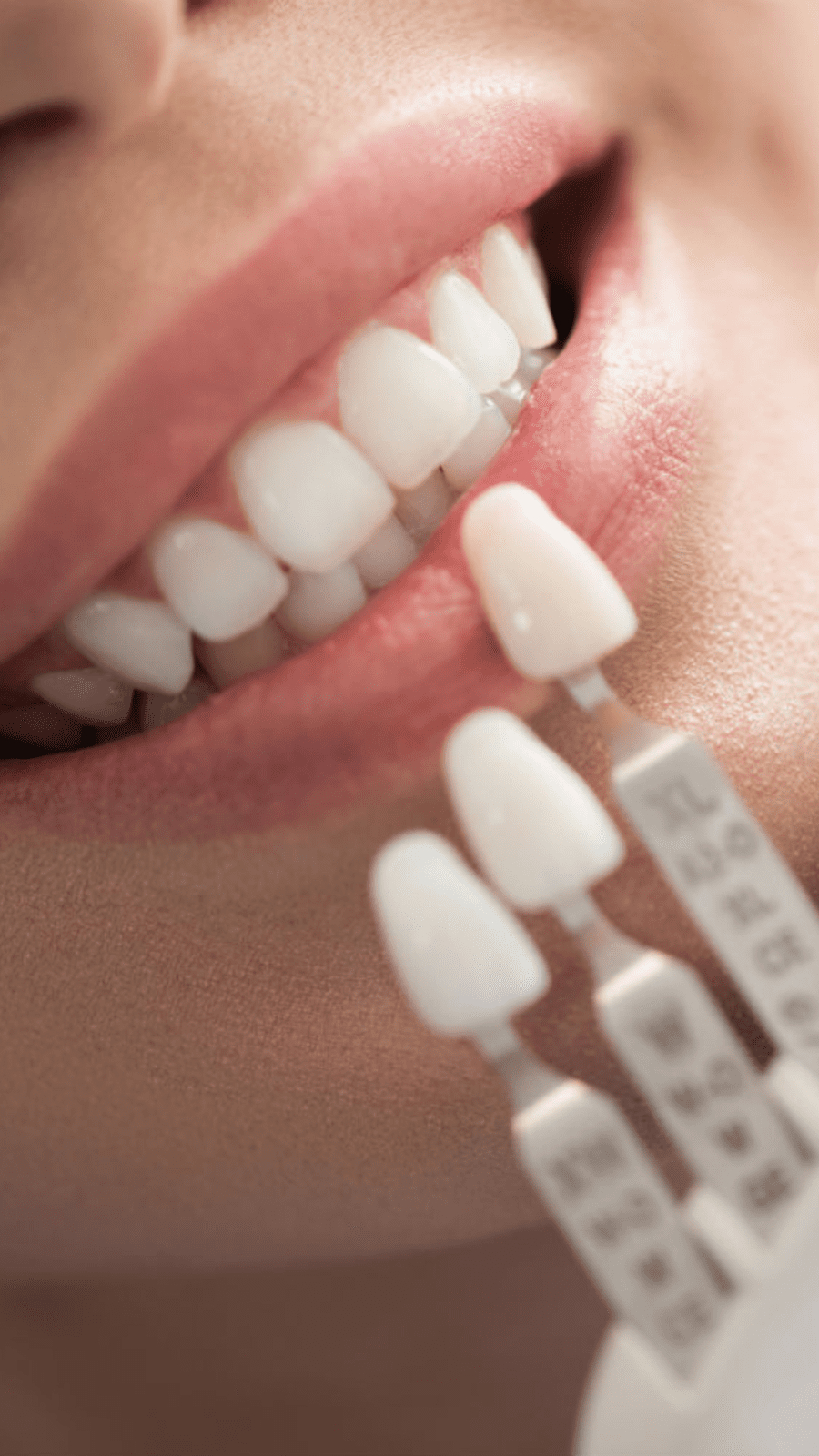 Woman's smile comparing tooth colors.